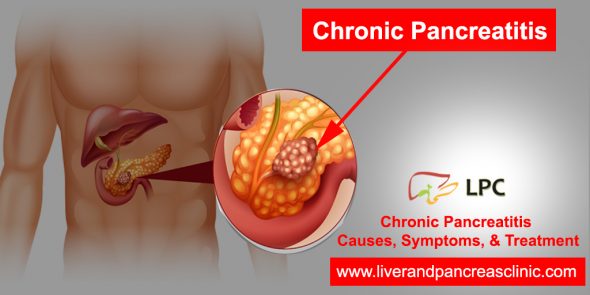 What Is Chronic Pancreatitis? Causes, Symptoms and Complications