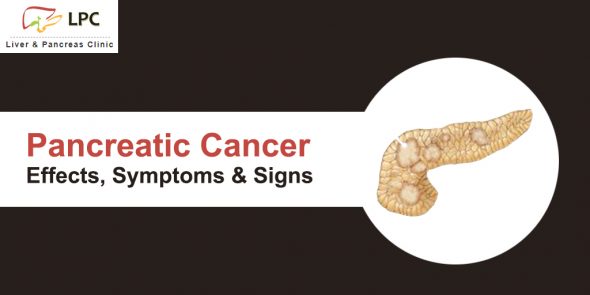 Pancreatic Cancer – Effects, Symptoms and Signs You Should Know …