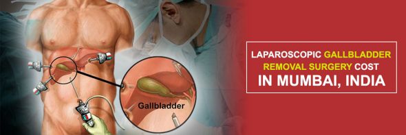 Gallbladder Removal Surgery Cost in Mumbai, India