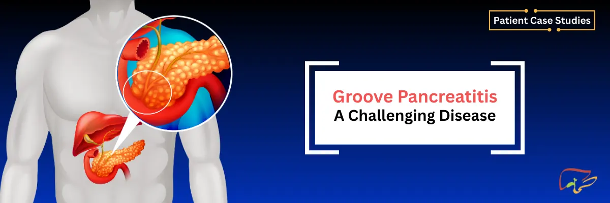 Groove pancreatitis - a challenging disease